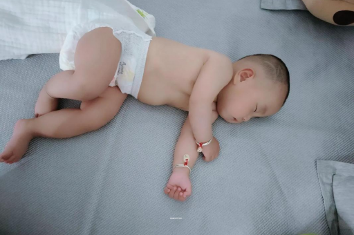 克拉玛依宝宝上火有眼屎
